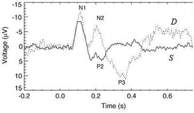 Neural Field Theory of Evoked Response Sequences and Mismatch Negativity With Adaptation